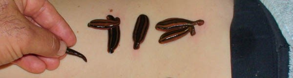 خواص زالو خواص زالو